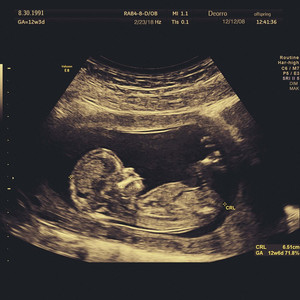 啊轻点灬太粗嗯太深了医生视频
